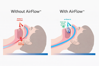 Adjustable Anti-Snoring Mouthpiece
